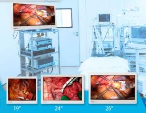 Monitoriai endoskopijai Medvix (19″, 24″, 26″)